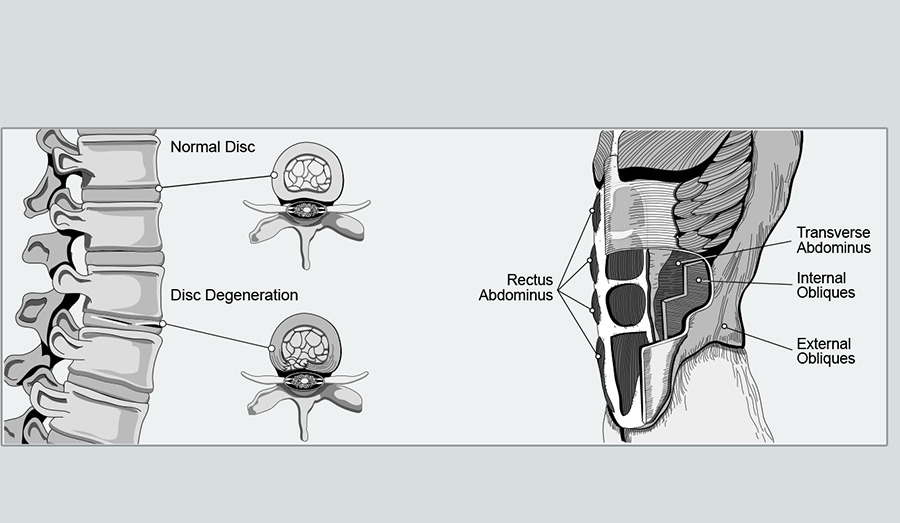 Spinal Discs, Abdominal Anatomy