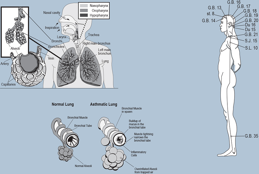 Three diagrams: Lungs, Normal Lung vs. Asthmatic Lung, Side view of human acupuncture points