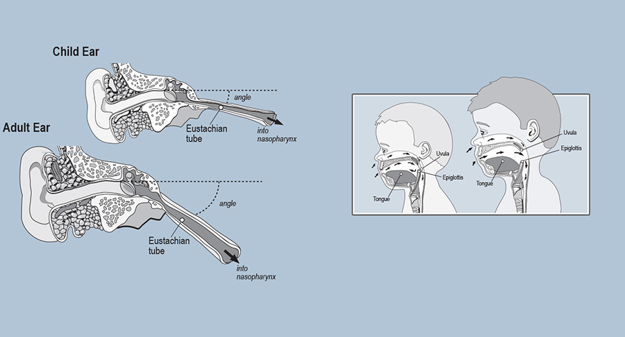 Two diagrams: Internal view of child ear vs. adult ear, Anatomy of child throat